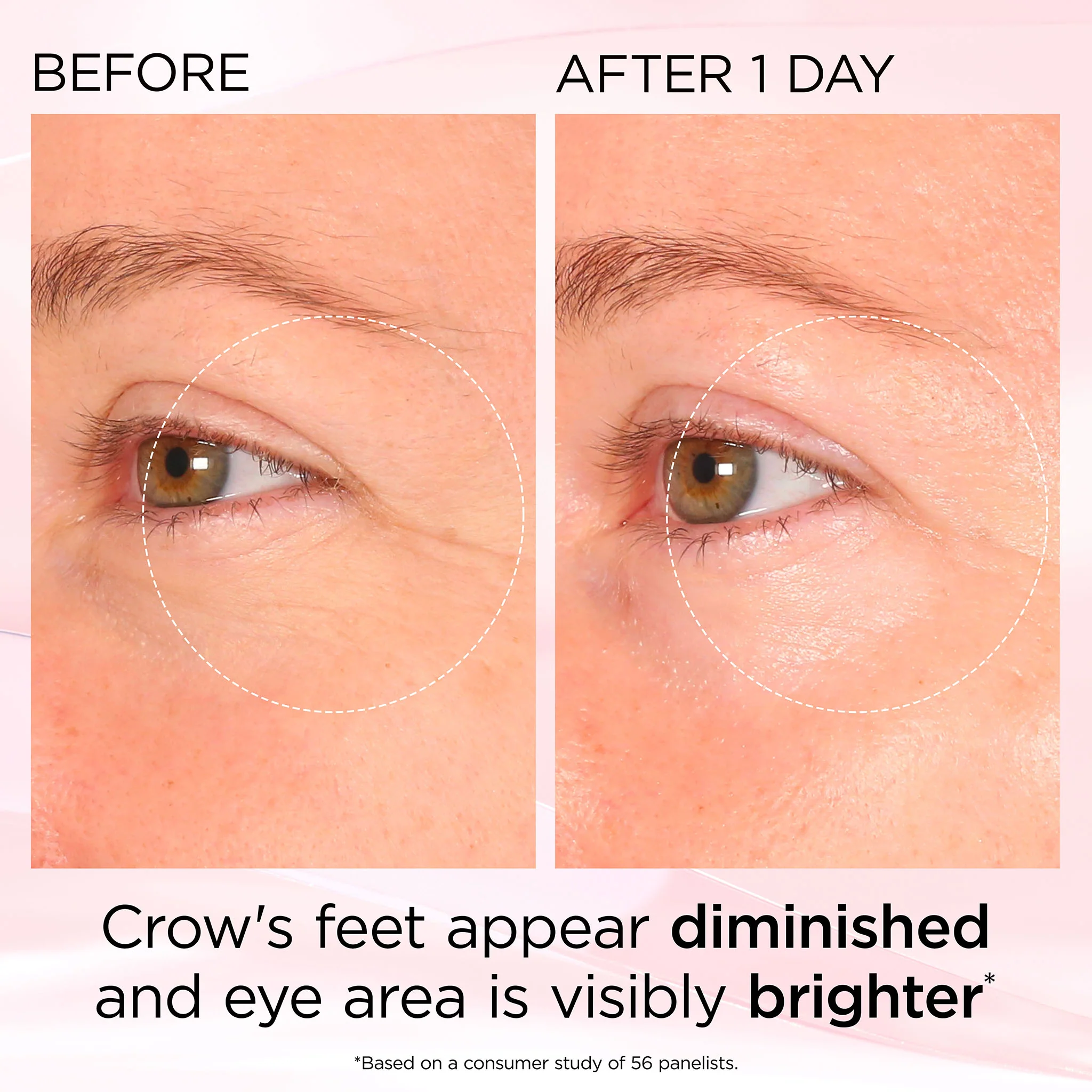 Retinol + HPR Ceramide Rapid Skin Renewing Eye Cream - Image 12